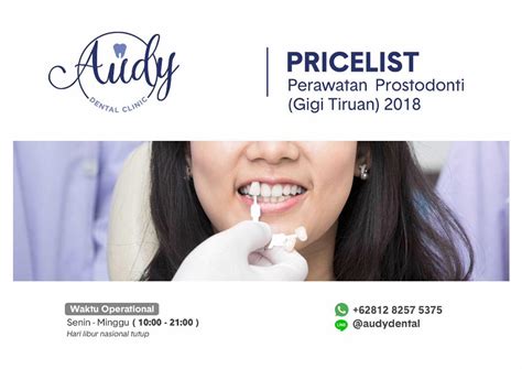 Jaringan Dokter Implant Pemasangan