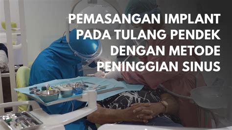 Kelebihan Pemasangan Implant