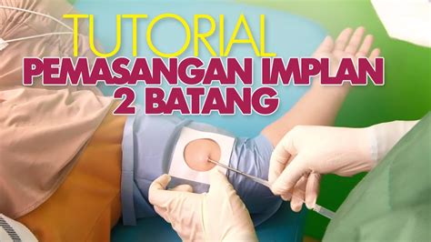 Tips Menjadi Sasaran Implant Pemasangan